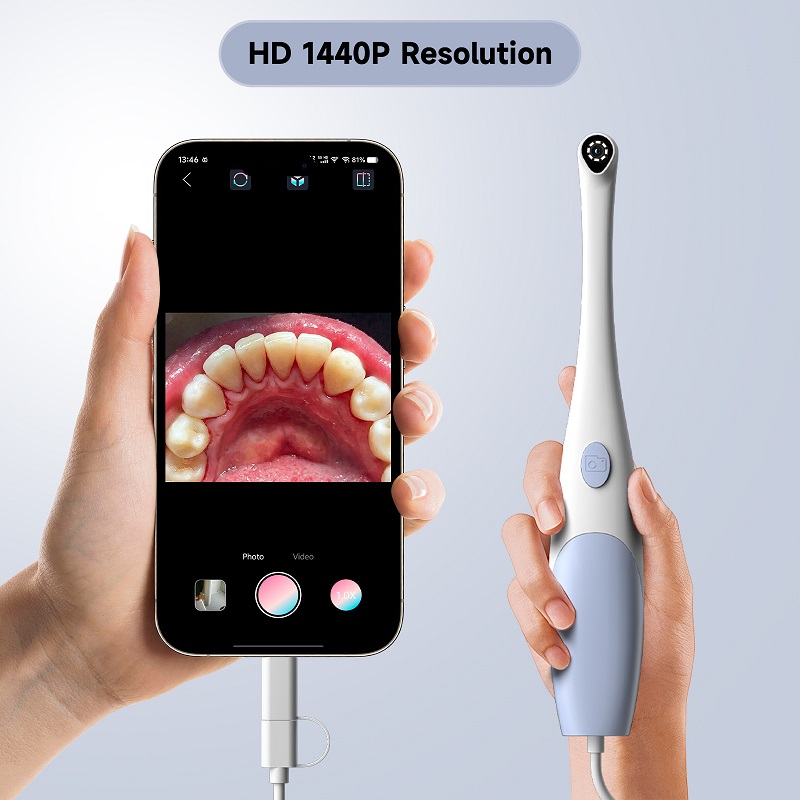 Telecamera Endoscopica Orale 1 - Photography Lighting Handheld recensione e prezzo