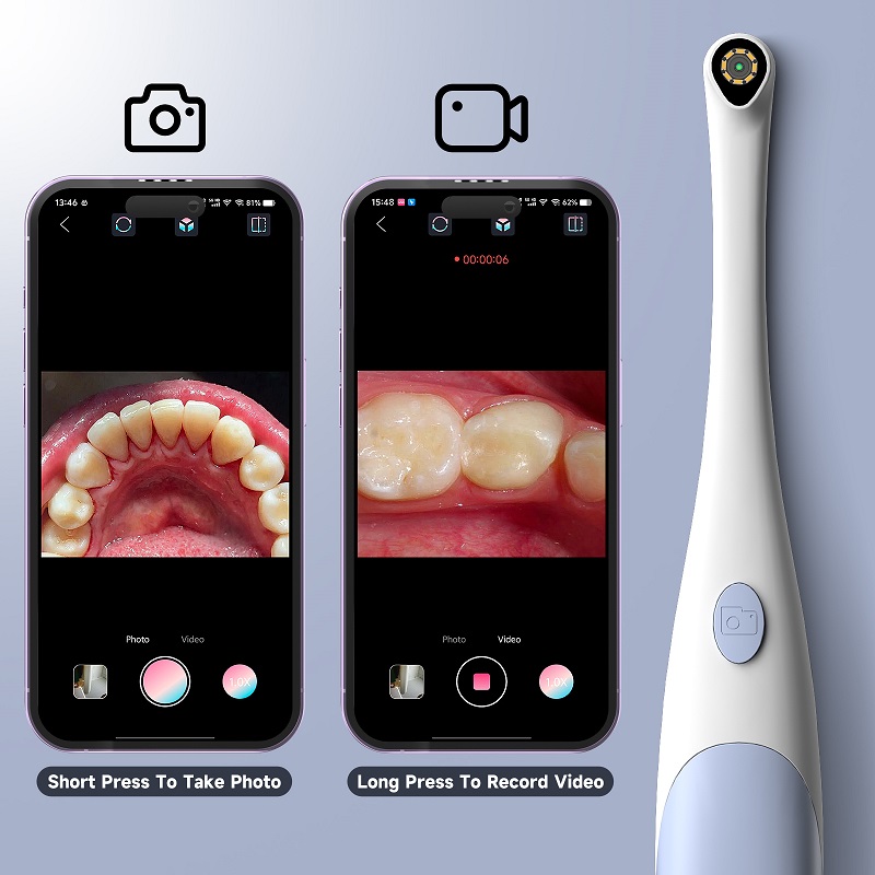 Telecamera Endoscopica Orale 1 - Photography Lighting Handheld recensione e prezzo